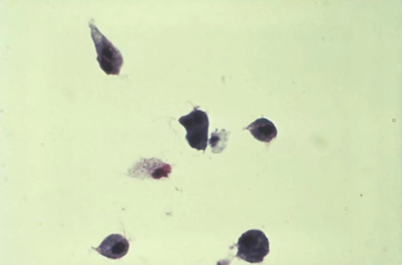 Trichomonas vaginalis trophozoites, a flagellated protozoan parasite. CDC PHIL #5237, 1986. Public domain.